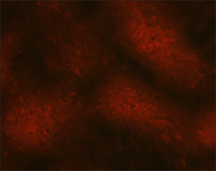 "A micrograph showing a dull reddish-brown area, with a distinct lack of green fluorescence, which would indicate the presence of rabies virus particles.  "