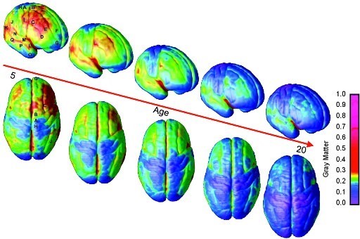 Una imagen del desarrollo del cerebro humano.