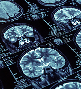 CT scans of the human brain