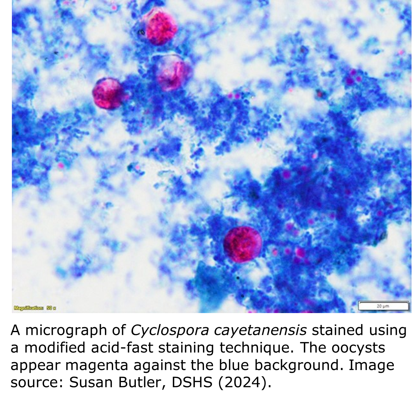 A micrograph of an acid-fast stained stool sample pics