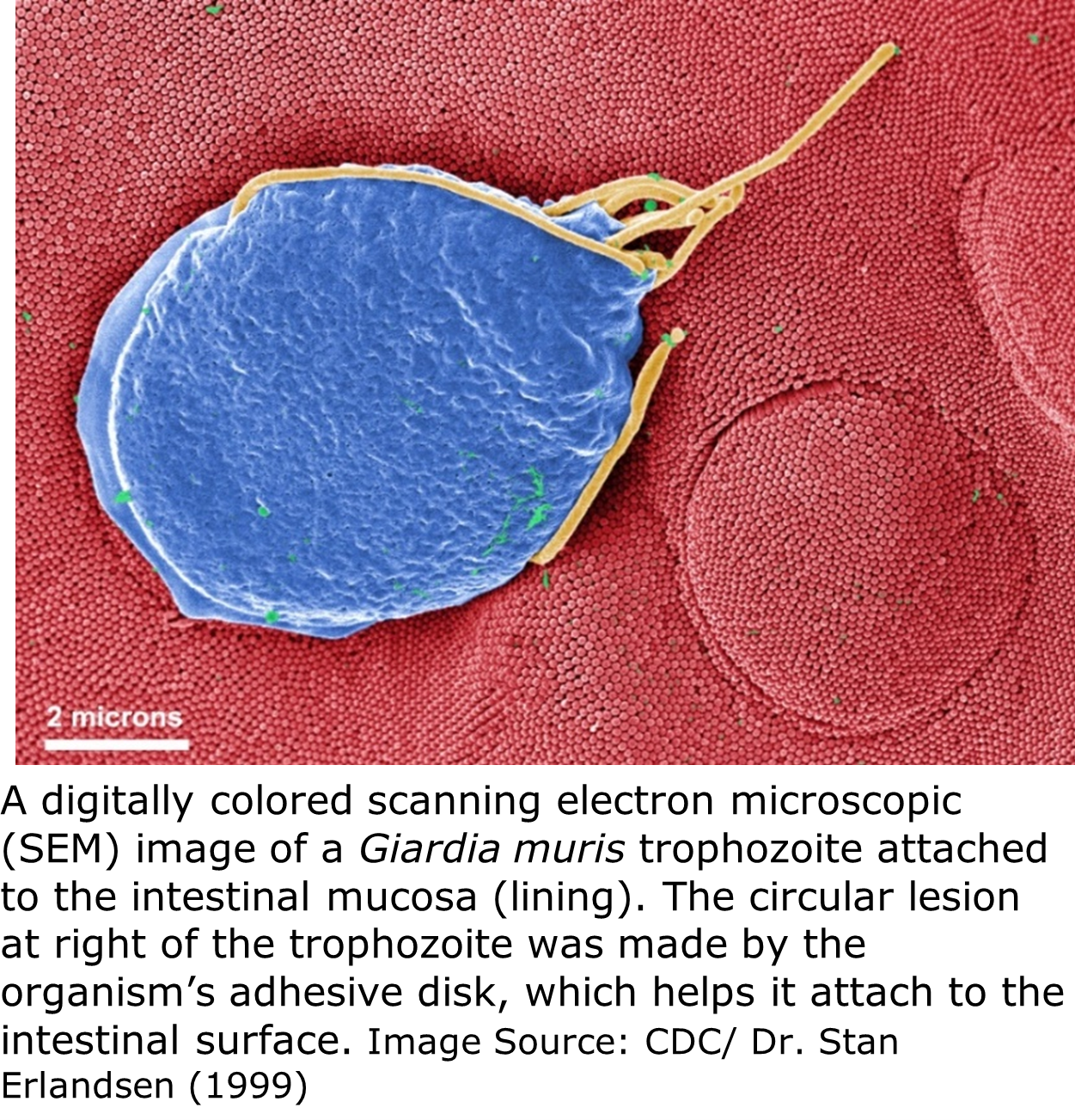 An electron microscopic image of a giardia parasite attached to the intestinal mucosa