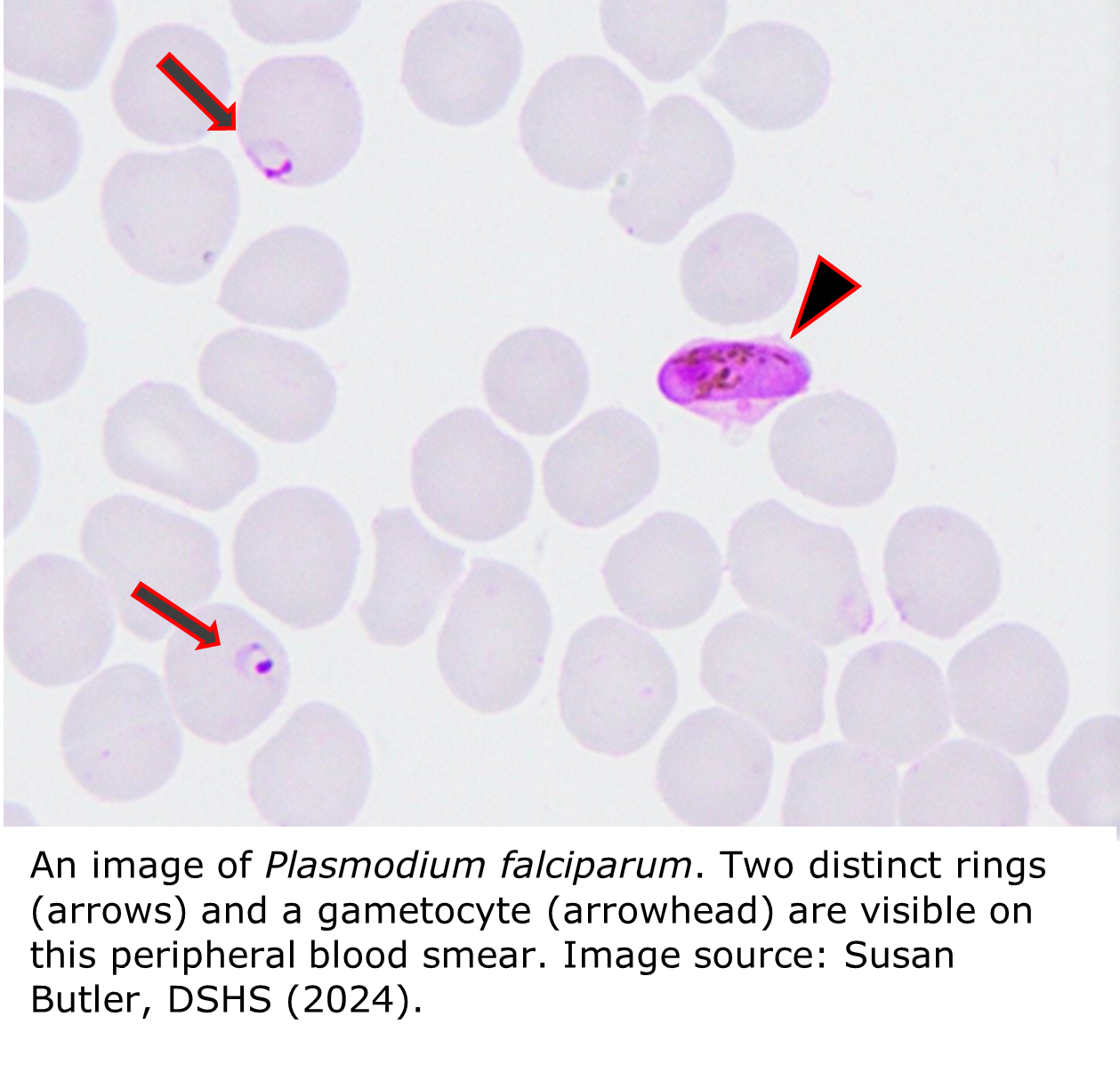 An image of Plasmodium falciparum